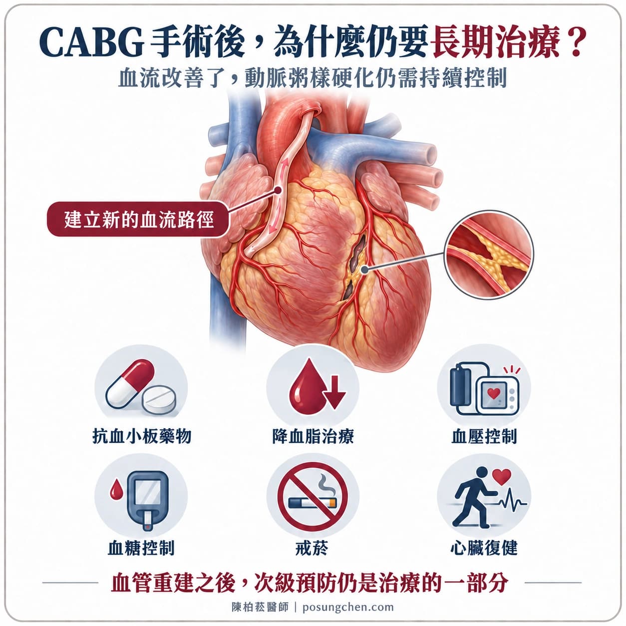 CABG 血管重建後仍需持續抗血小板藥物、降血脂治療、血壓與血糖控制、戒菸及心臟復健