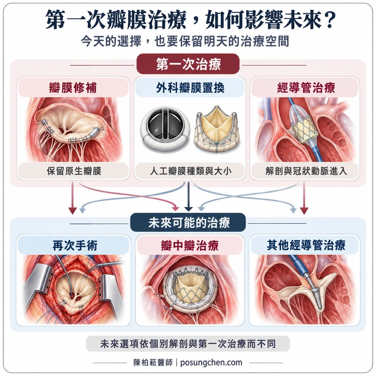 第一次瓣膜修補、外科瓣膜置換或經導管治療,可能影響未來再次手術、瓣中瓣與其他經導管治療的選項