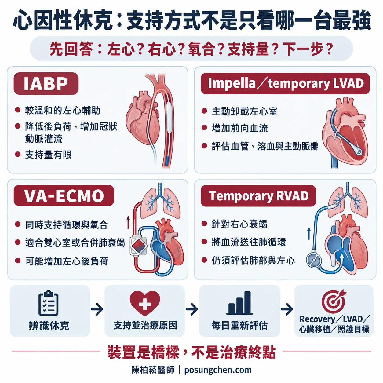 心因性休克暫時性循環支持選擇:比較 IABP、Impella 或 temporary LVAD、VA-ECMO 與 temporary RVAD 的主要支持目標與限制