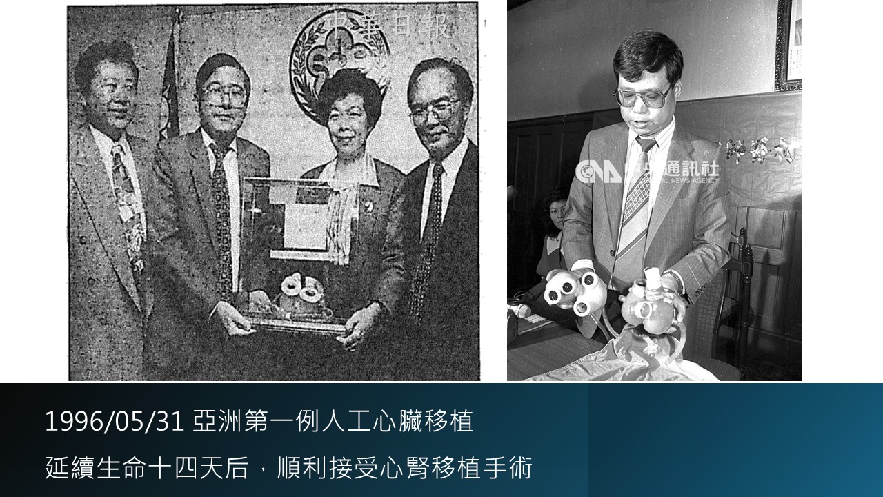 1996 年振興醫院亞洲第一例人工心臟移植歷史照片
